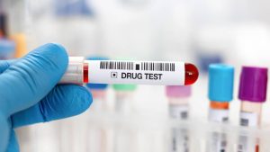 Test Positive on a DOT Drug Test